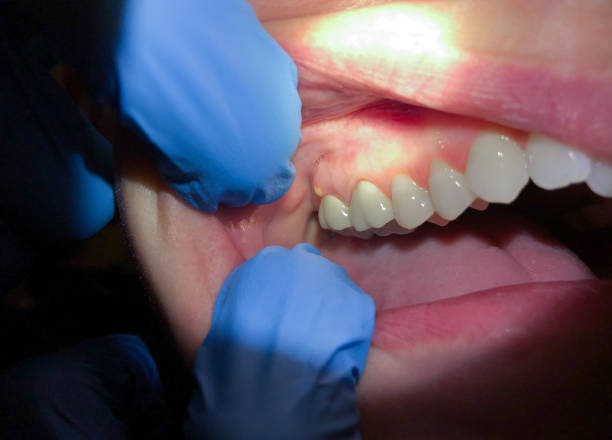 Best Broken or Cracked Tooth Emergency Dentist in Stateburg, SC