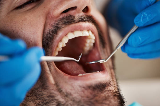 Best Pediatric Emergency Dentist in Stateburg, SC